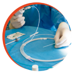 Cirurgia Procedimento Minimamente Invasiva 150x150 2